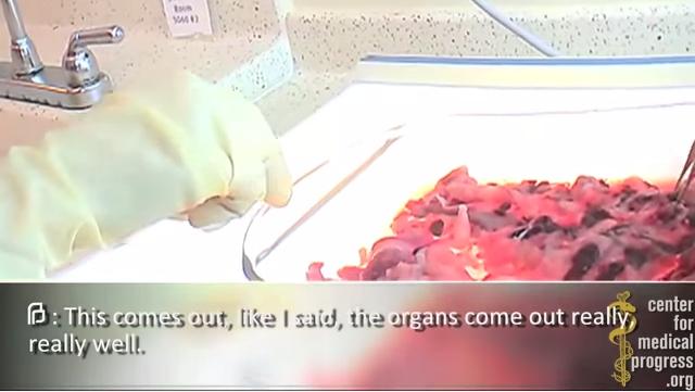 organs come out well in abortion